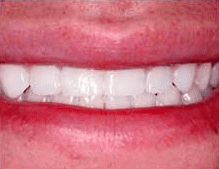 teeth2 Michael Kim, DDS