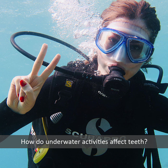 underwater teeth 2022 700 Michael Kim, DDS